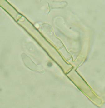 Amphinema byssoides? (Amphinema byssoides)